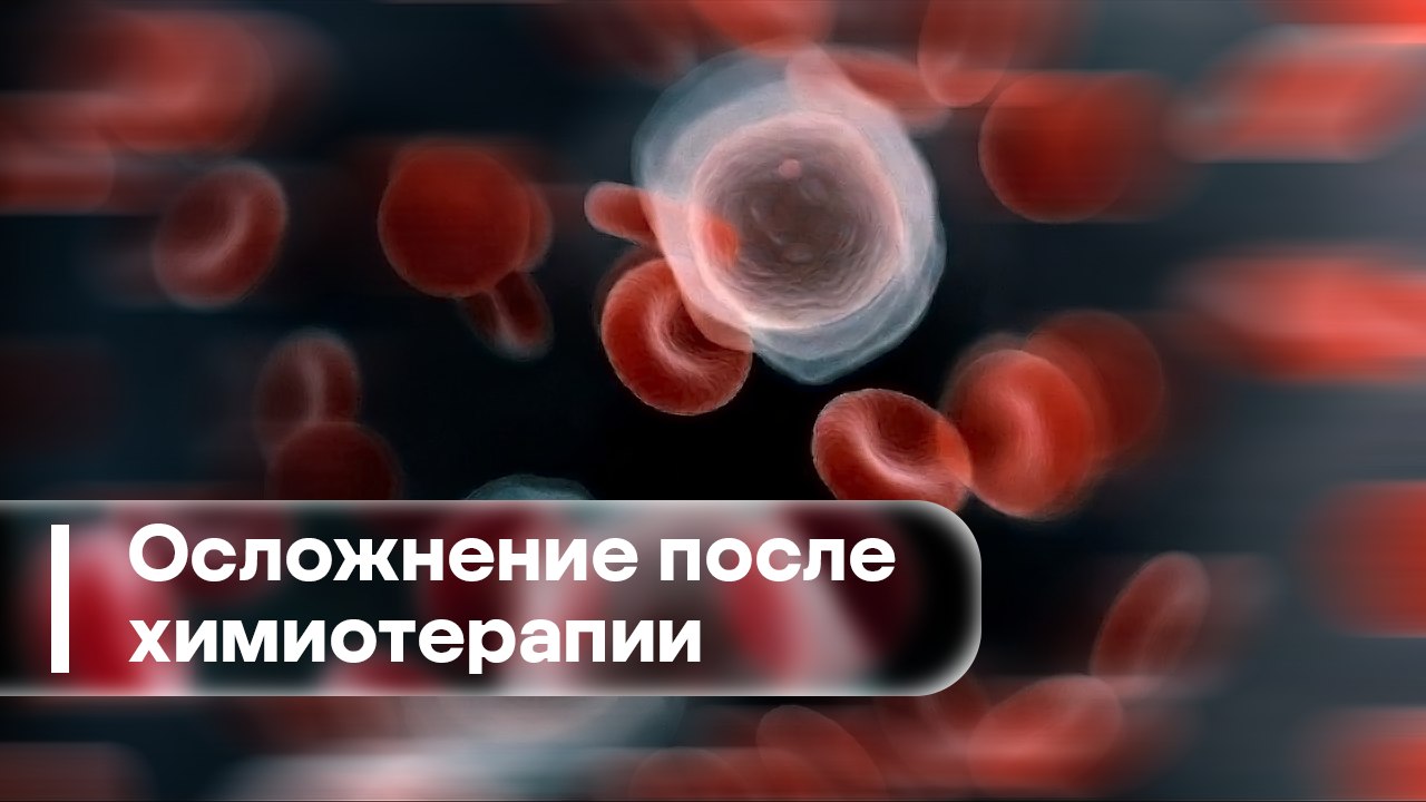 Осложнение после химиотерапии